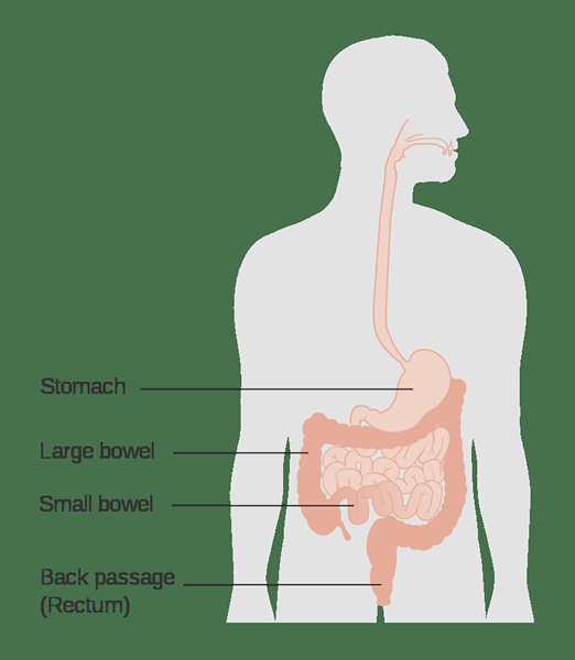 Was ist der Unterschied zwischen Gastroparese und Dumping -Syndrom