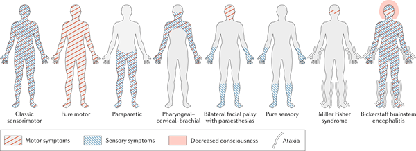 Quelle est la différence entre le syndrome de Guillain Barre et Myasthenia Gravis