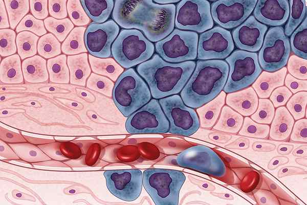 Apakah perbezaan antara sel HeLa dan sel -sel kanser