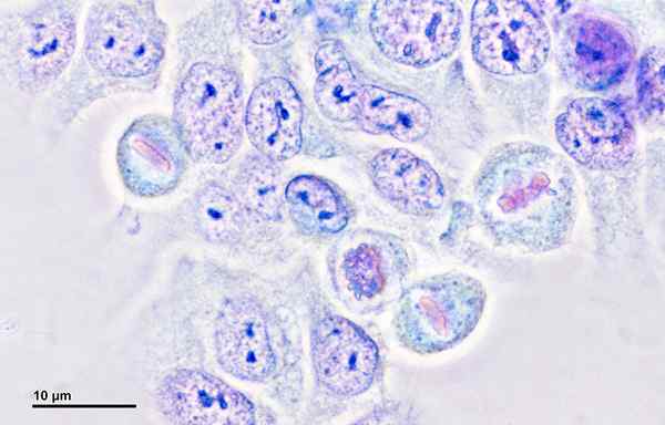 Apakah perbezaan antara sel HeLa dan sel biasa