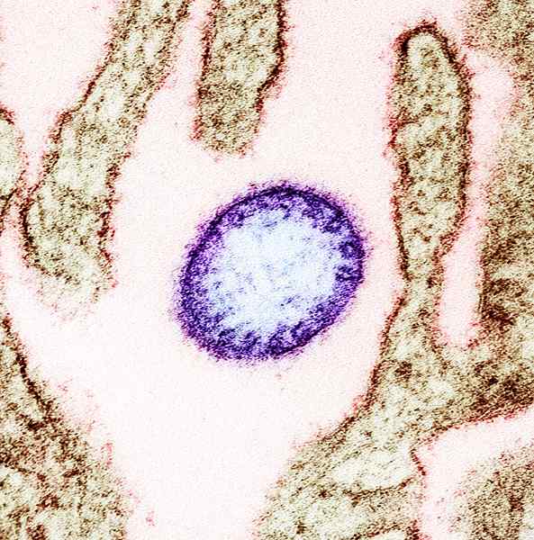 Was ist der Unterschied zwischen Hendravirus und Nipahvirus