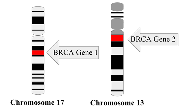 Was ist der Unterschied zwischen HER2 und BRCA