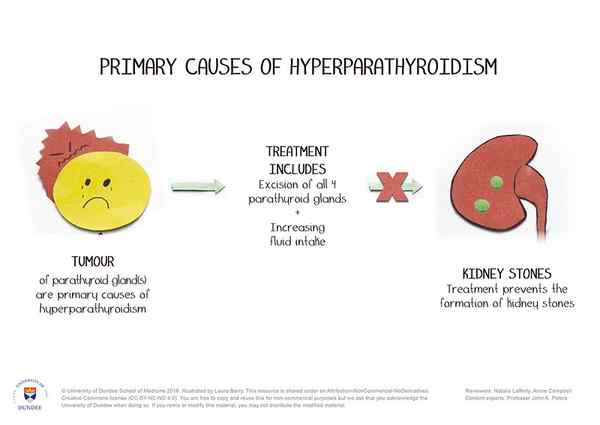 Apa perbedaan antara hiperparatiroidisme dan hipertiroidisme