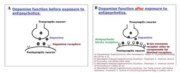 Apakah perbezaan antara L dopa dan dopamin