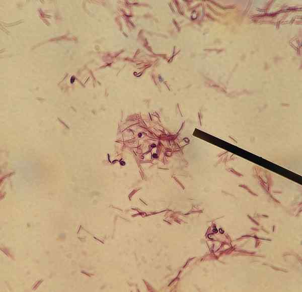 Apa perbedaan antara Lactobacillus rhamnosus dan Lactobacillus reuteri