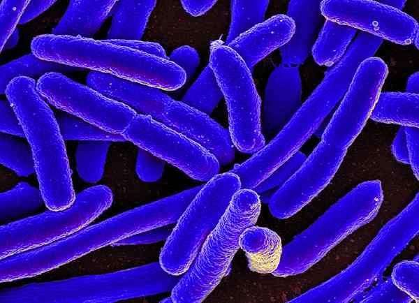 Apakah perbezaan antara penapaian laktosa dan bakteria penapaian bukan laktosa