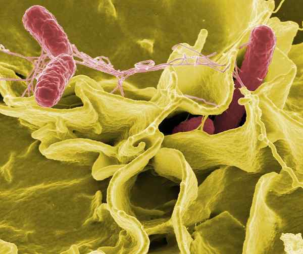 ¿Cuál es la diferencia entre Listeria y Salmonella?