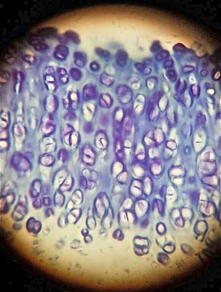 Quelle est la différence entre la métachromasie et la métachromatique