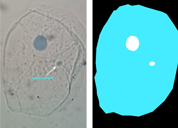 ¿Cuál es la diferencia entre Micronucleus y el ensayo de cometa?