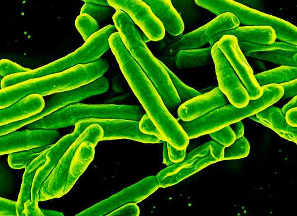¿Cuál es la diferencia entre Mycobacterium tuberculosis y Mycobacterium leprae