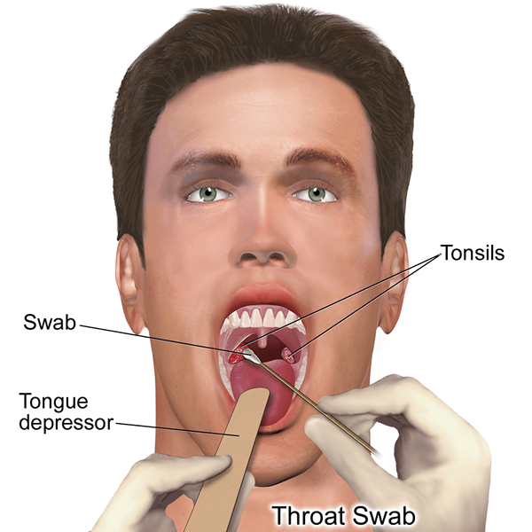 Apakah perbezaan antara swab nasopharyngeal dan oropharyngeal