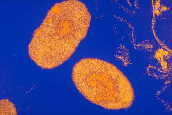 ¿Cuál es la diferencia entre la tos ferina y la tuberculosis?