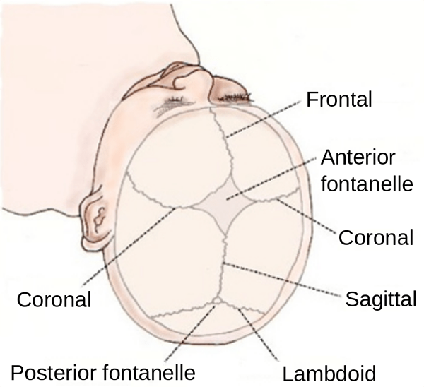Apa perbedaan antara plagiocephaly dan craniosynostosis