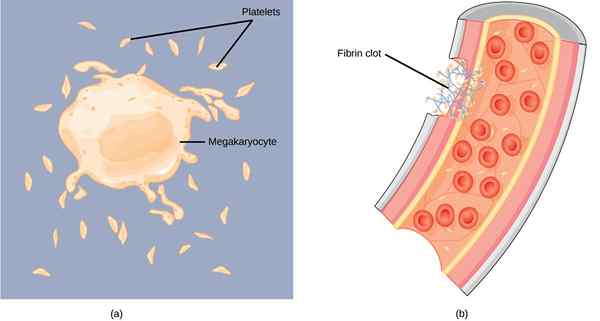 Apakah perbezaan antara palam platelet dan bekuan darah