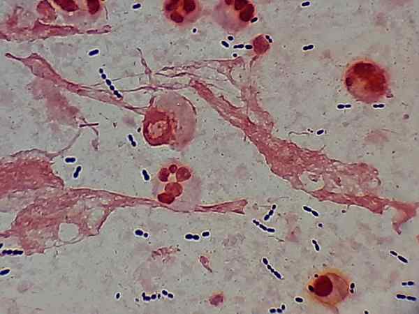 Apakah perbezaan antara sel nanah dan sel epitelium
