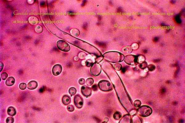 Was ist der Unterschied zwischen Saccharomyces cerevisiae und Candida albicans