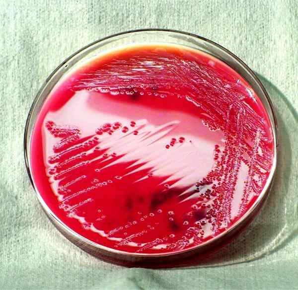 Apakah perbezaan antara Salmonella dan Shigella