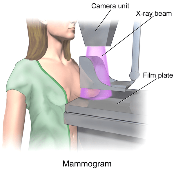 ¿Cuál es la diferencia entre la mamografía de detección y la mamografía diagnóstica?