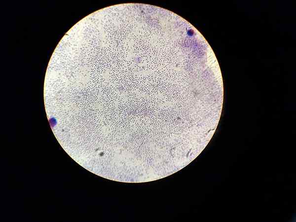 Apakah perbezaan antara Streptococcus pneumoniae dan Diplococcus pneumoniae