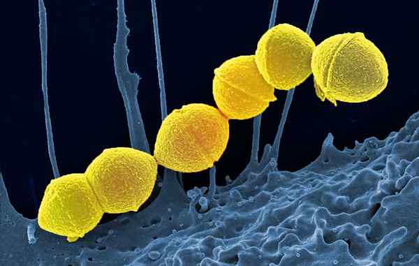 Apa perbedaan antara streptokinase dan TPA