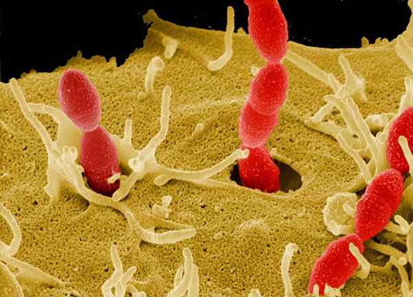 Apa perbedaan antara Streptomyces dan Streptococcus