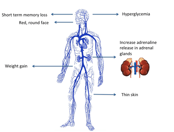 Was ist der Unterschied zwischen Symptom und Syndrom