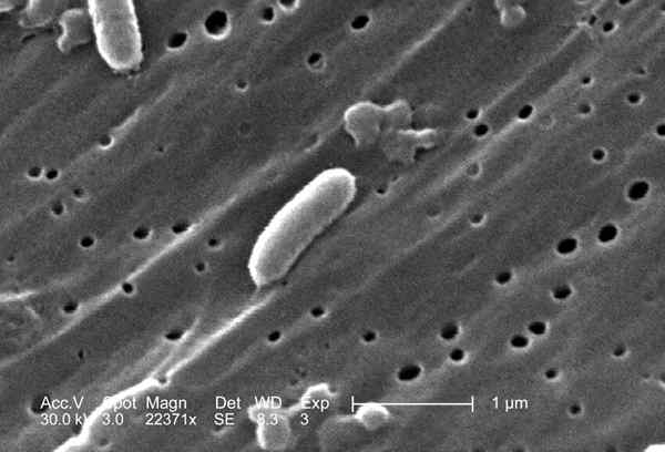 Was ist der Unterschied zwischen Vibrio Cholerae und Vibrio parahaemolyticus