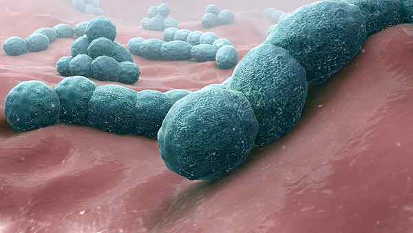Was ist der Unterschied virale Lungenentzündung und bakterielle Pneumonie