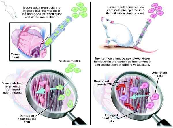 Perbezaan antara sel stem dewasa dan embrio