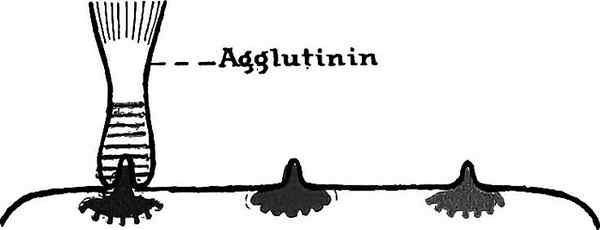 Différence entre les agglutinogènes et les agglutinines