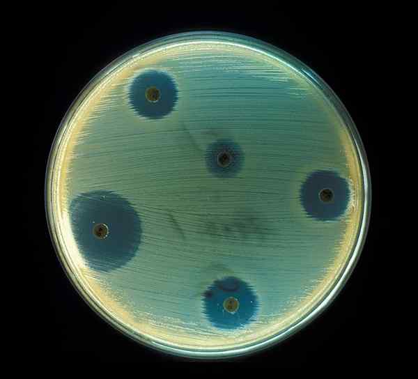 Perbezaan antara allelopathy dan antibiosis