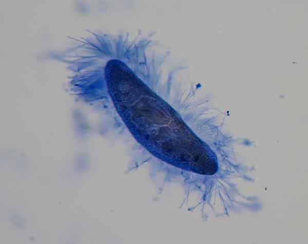 Diferencia entre ameba y paramecium