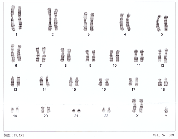 Perbezaan antara aneuploidy dan polyploidy