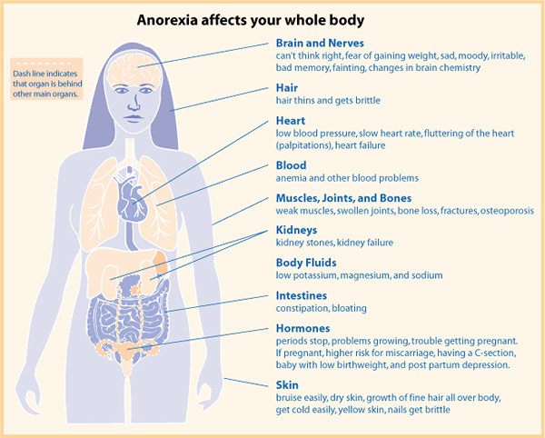 Perbezaan antara anoreksia dan anoreksia nervosa