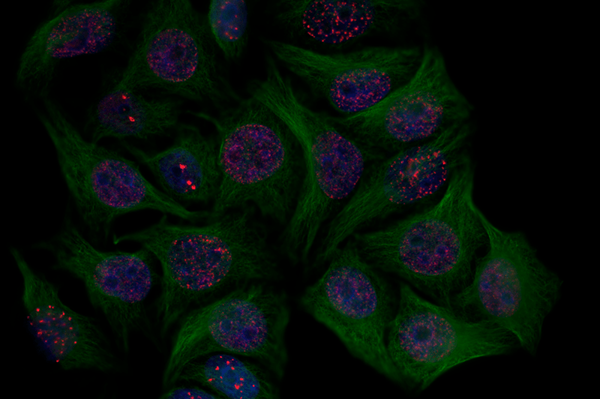 Perbedaan antara apoptosis dan penuaan