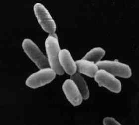 Différence entre les archébactéries et la paroi cellulaire des eubactéries