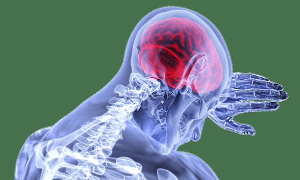 Diferencia entre la hemorragia cerebral y el accidente cerebrovascular