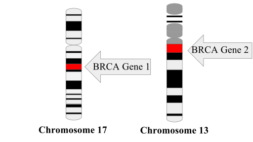 Diferencia entre la mutación BRCA1 y BRCA2