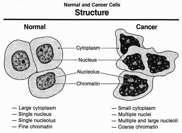 Diferencia entre las células cancerosas y las células normales