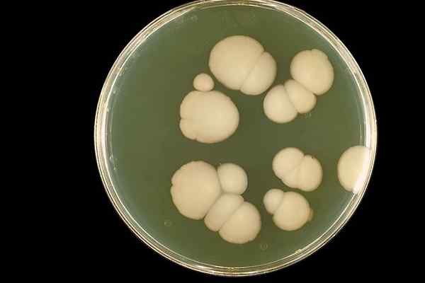 Diferencia entre candida e infección por levaduras