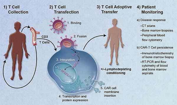 Diferencia entre Car-T y TCR-T