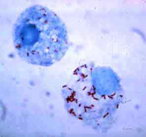 Unterschied zwischen Chlamydien und Rickettsia