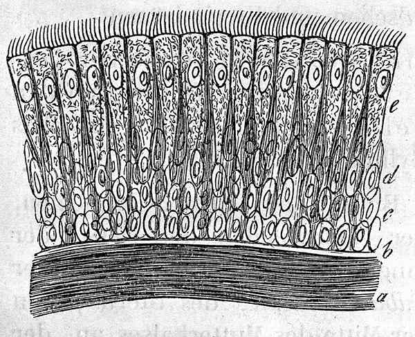 Perbezaan antara sel epitelium ciliated dan sel epitelium squamous