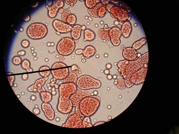 Perbezaan antara koacervates dan microsferes