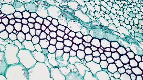 Différence entre le collenchyme et le chlorenchyme