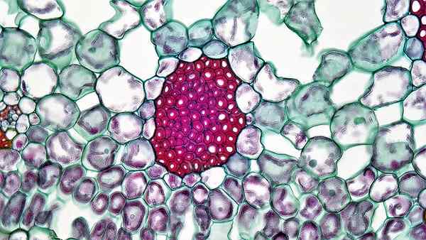 Perbedaan antara collenchyma dan sclerenchyma