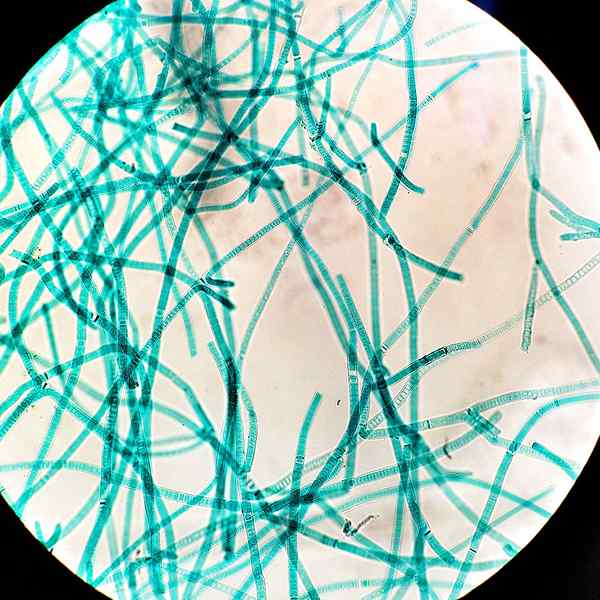 Perbedaan antara cyanobacteria dan proteobacteria