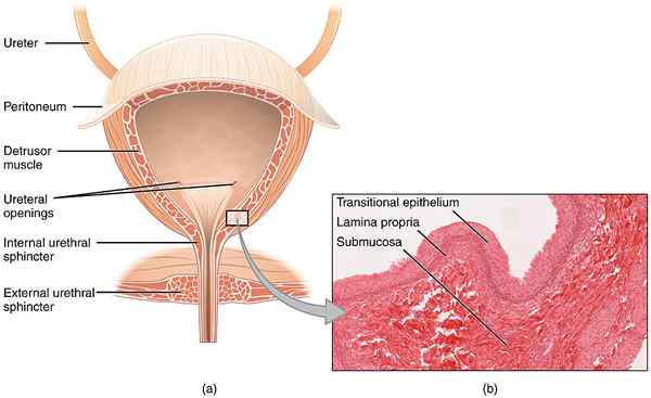 Perbezaan antara cystitis dan pyelonephritis