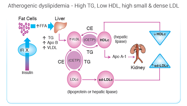 Différence entre la dyslipidémie et l'hyperlipidémie