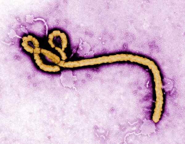 Différence entre Ebola et Marburg